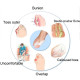 Разделител за кокалче на крака - Облекчаване на болка и комфорт